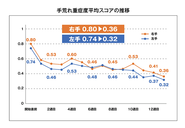 手荒れ重症度平均スコアの推移 グラフ