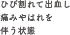 ひび割れて出血し痛みやはれを伴う状態