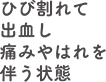 ひび割れて出血し痛みやはれを伴う状態