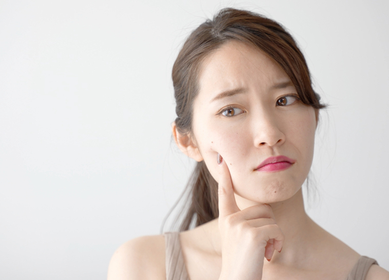 【医師監修】ちょっとひどくて気になるニキビの原因や種類・予防法まで