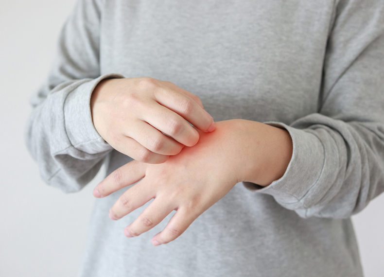 【医師監修】手湿疹はなぜできる？原因や対処法、予防策まで徹底解説！