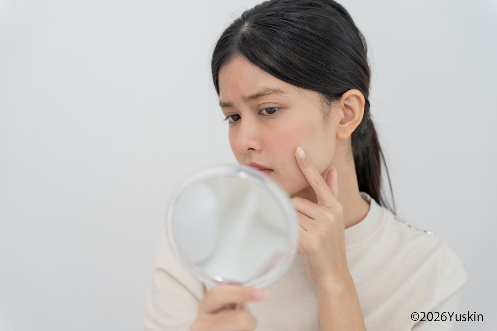 肌荒れで赤みが出る理由とは？スキンケア方法と予防するポイントも解説